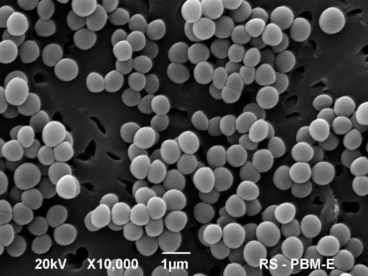 3. S.Aureus M. Kaus Drobek Pracownia Inżynierii Białek IMDiK PAN zdj. R. Strzałkowski