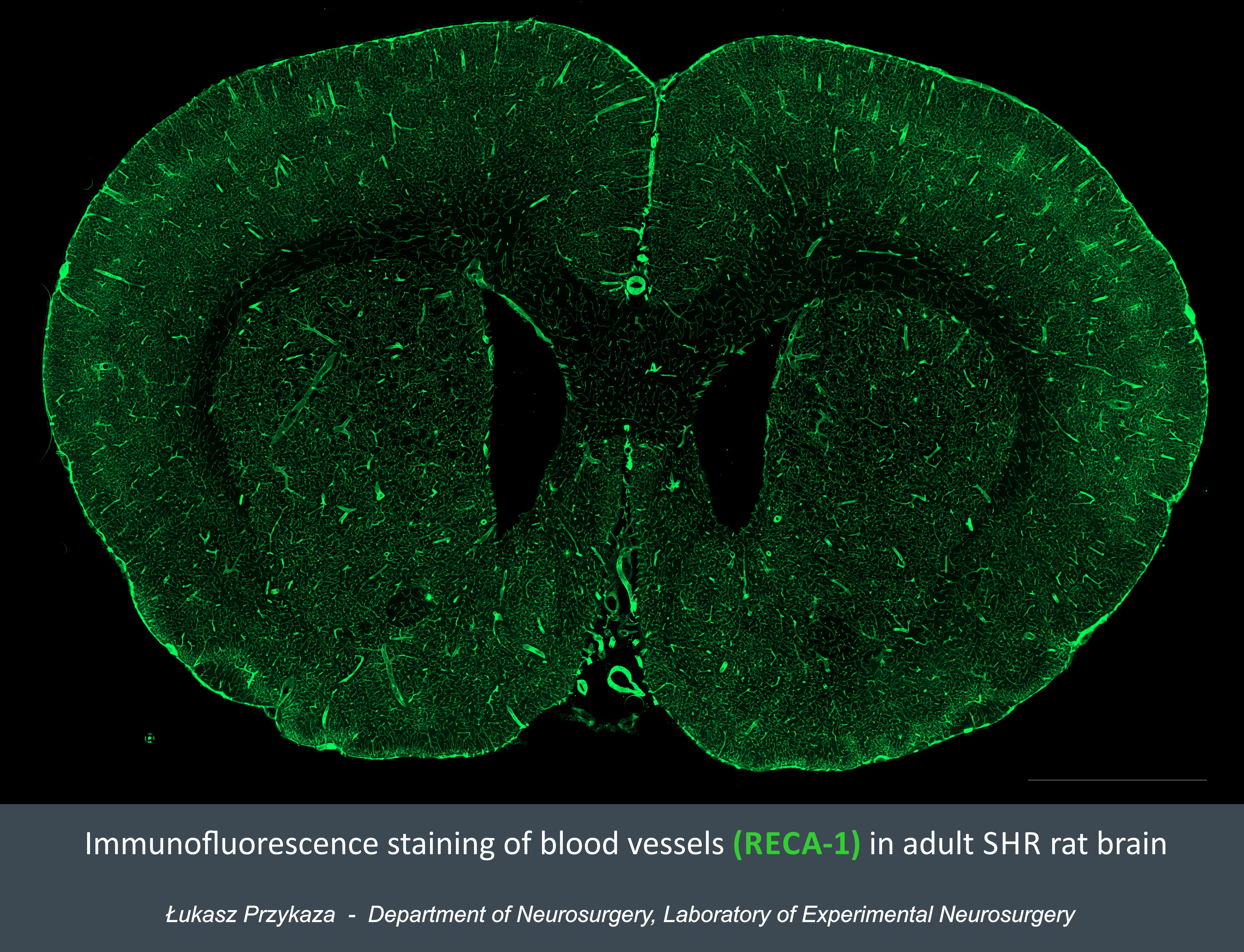 2. Cell Observer Brain 150 dpi